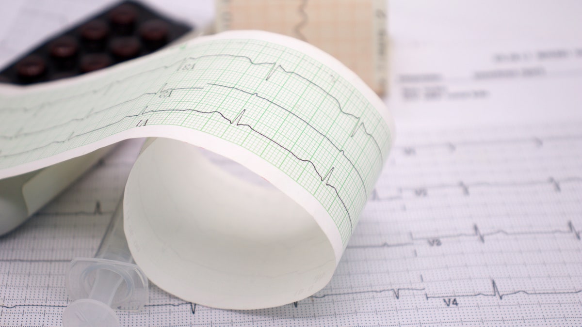 About Supraventricular Tachycardia (SVT)