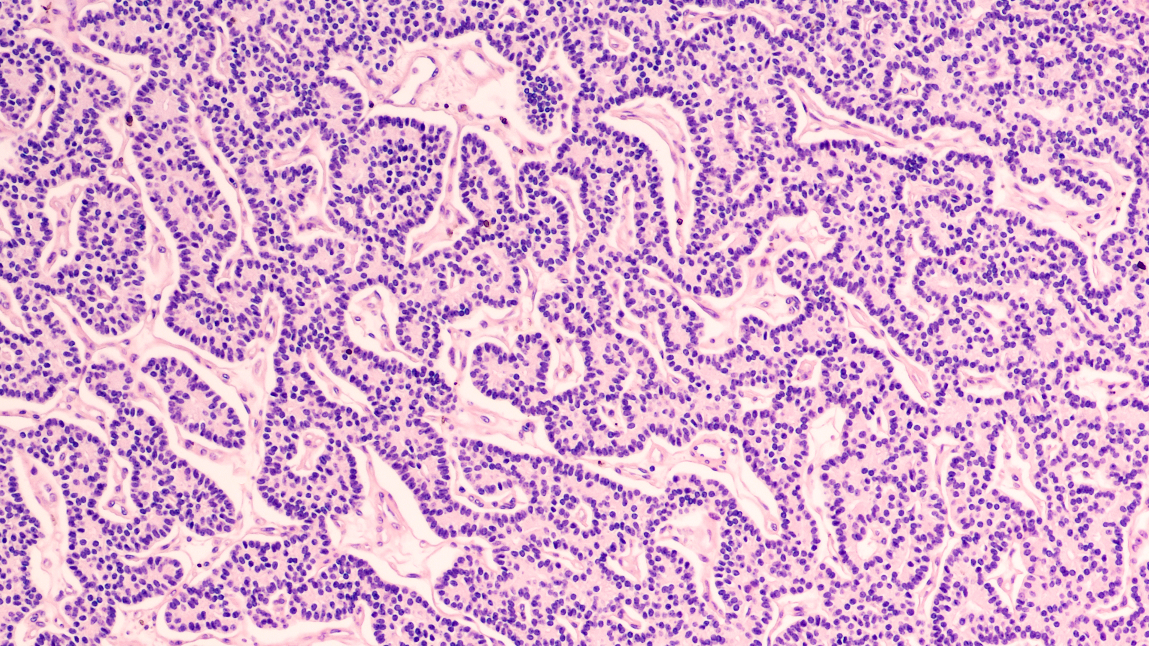 About Lynch Syndrome