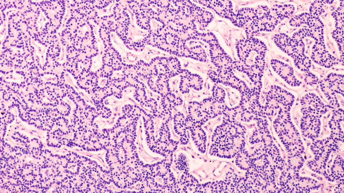 About Lynch Syndrome