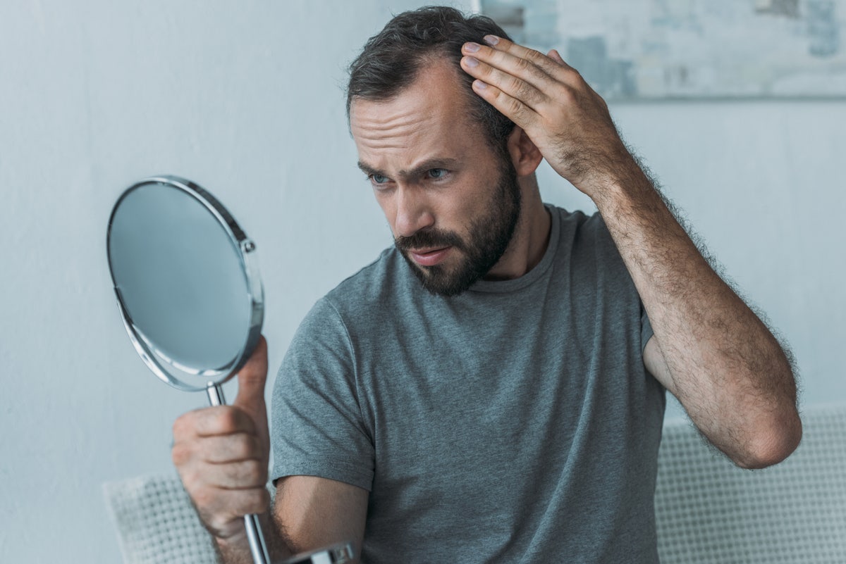 Hair Loss As A Symptom Of Hashimoto s Disease hair-loss-as-a-symptom-of-hashimoto-s-disease