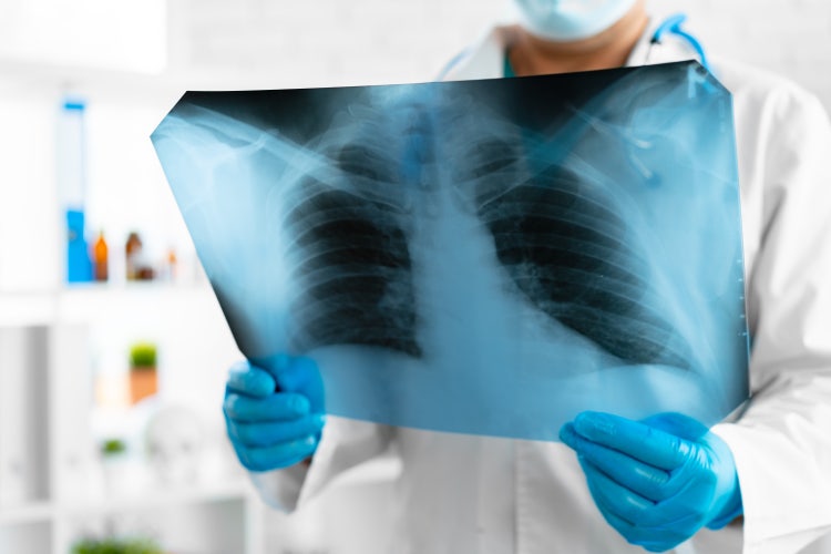 About Ventilator Associated Pneumonia (VAP) | Health Answers by Pfizer